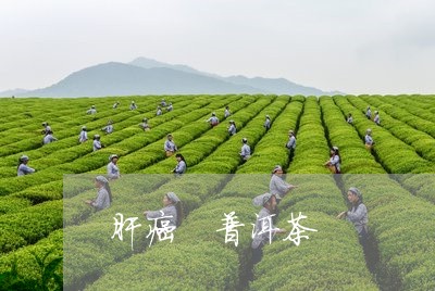 肝癌 普洱茶/2023042811131